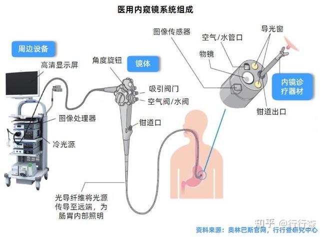 口腔内镜和内窥镜的区别