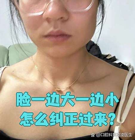 左右脸一边大一边小截图1