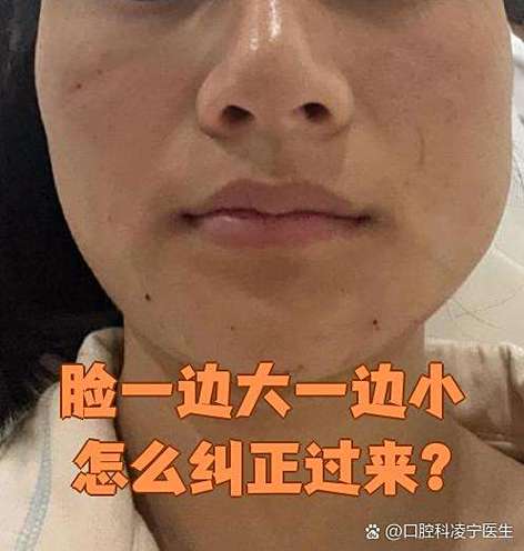 左右脸一边大一边小截图2