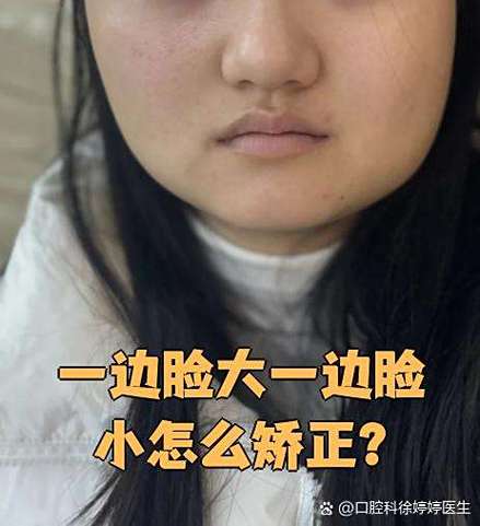 左右脸一边大一边小截图3