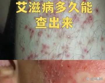 小鸟体内注入艾滋病毒会怎样