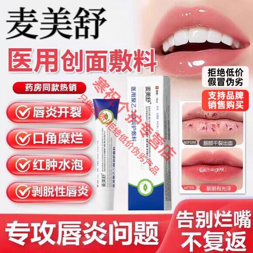 嘴唇上溃疡用什么药