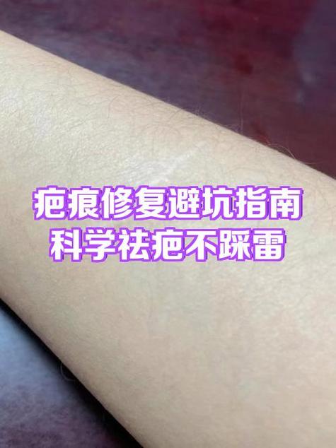 凹的疤痕怎么修复