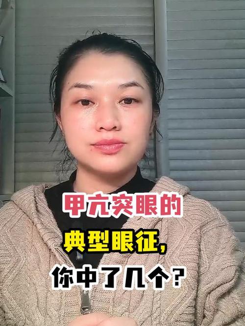 甲亢突眼的六个眼征