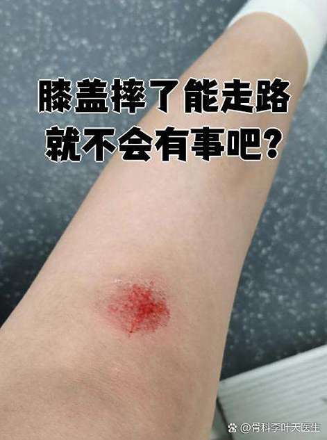 走路伤膝盖吗