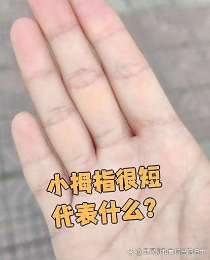 左手小拇指短