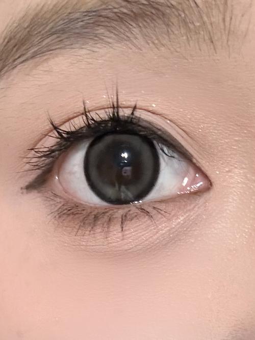 黑眼珠变小了怎么恢复