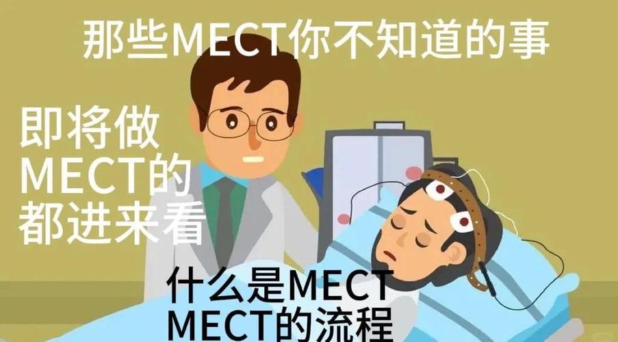 做mect可以不住院吗