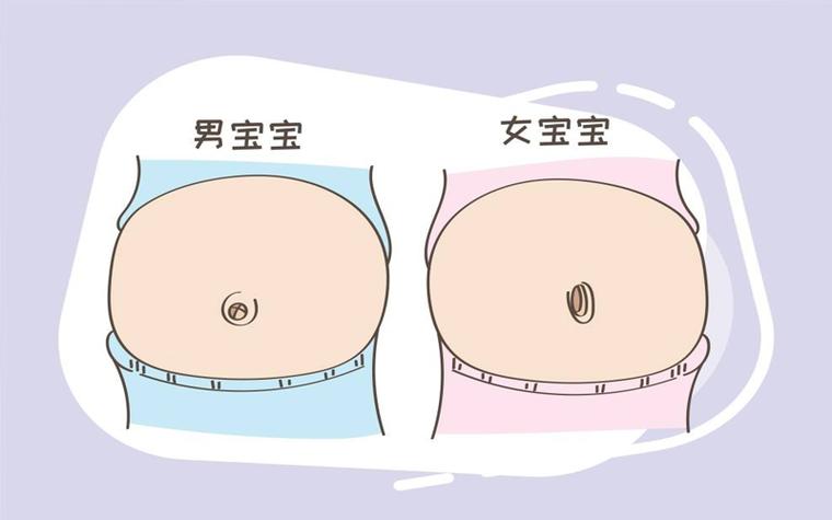 生儿子肚脐眼一定会凸起吗