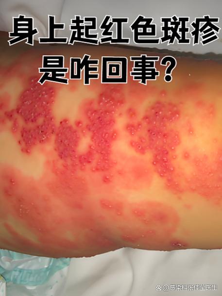 犇牛病毒中毒症状 犇牛病毒中毒症状