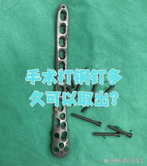 取钢钉最佳时间