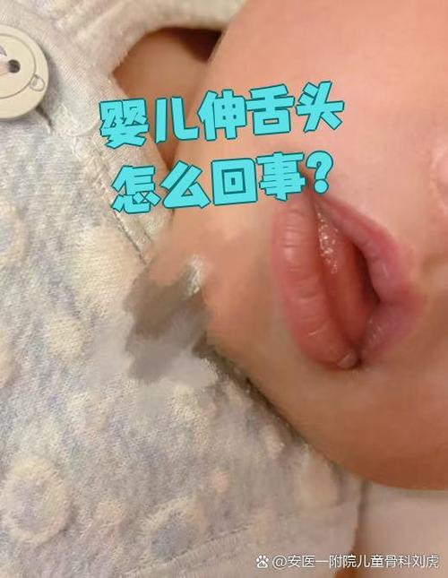 2个月宝宝吐舌头是怎么回事
