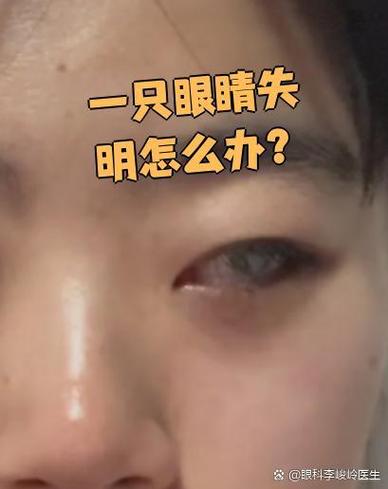 狼戈眼睛失明的原因是什么截图2