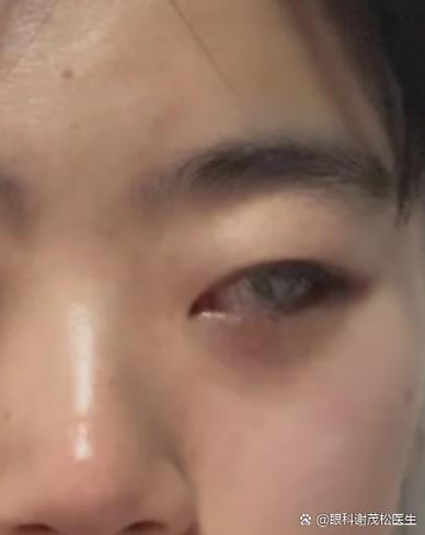 狼戈眼睛失明的原因是什么截图3