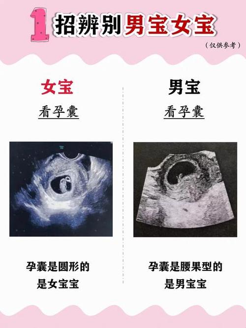怎么辨别男孩女孩
