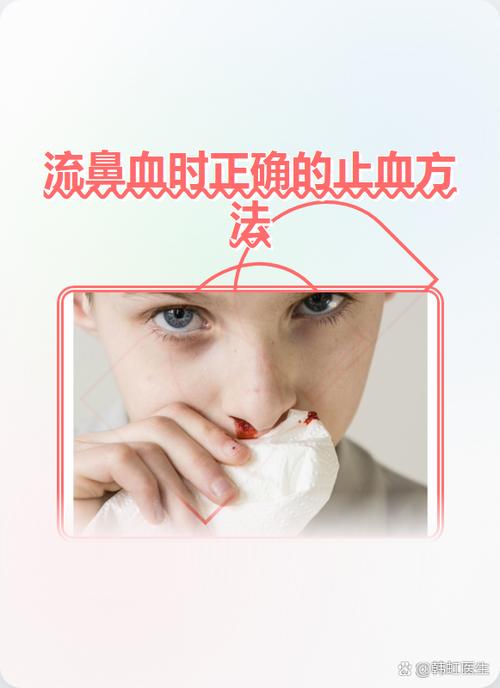 连续留鼻血四五天咋回事
