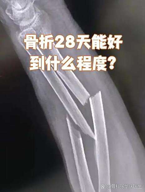 人的骨头多久会彻底消失截图3