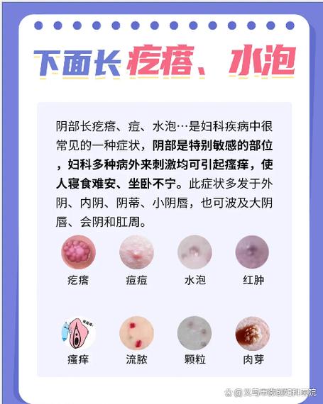 私密边上长个痘痘是什么原因