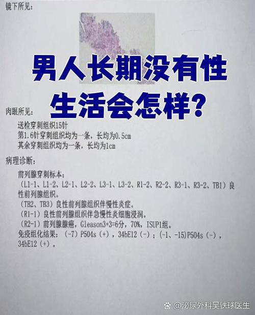 男人长期不同房有什么影响