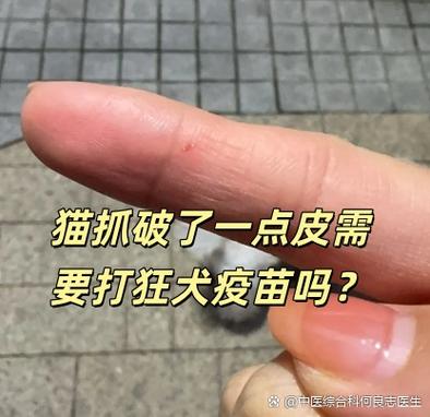 被猫挠了要打狂犬病疫苗吗