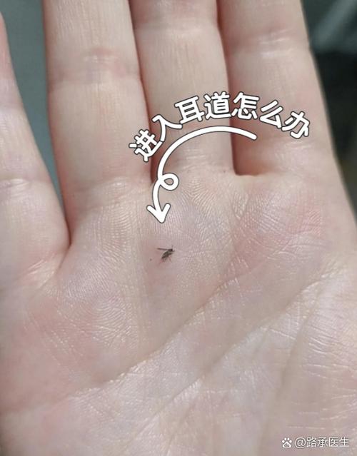 蚊子飞到耳朵里没动静