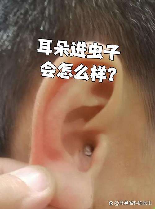 耳朵进虫子嗡嗡几声没反应了