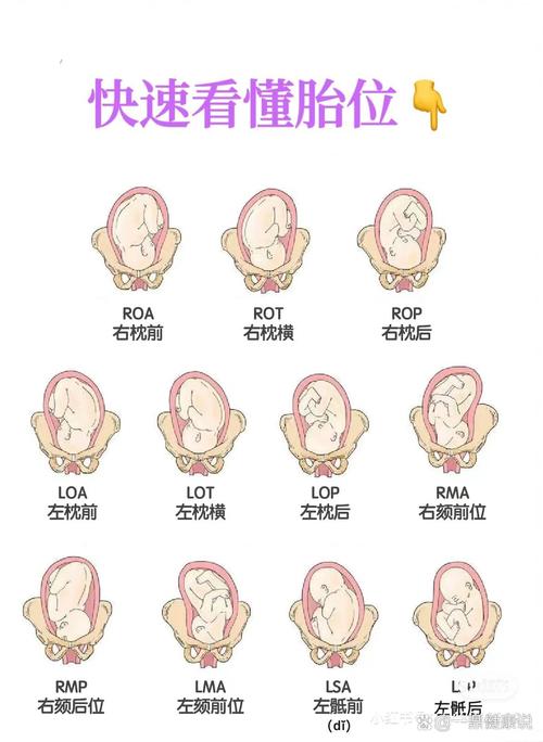胎儿横位是什么原因造成的