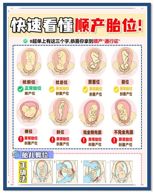胎儿横位是什么原因造成的截图3