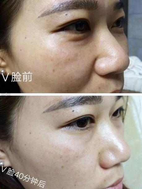 吉美能量v脸是真的吗