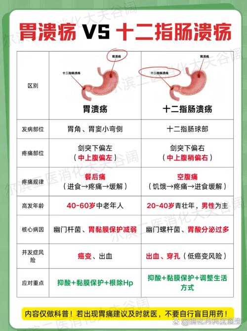 溃疡是什么原因引起的截图1