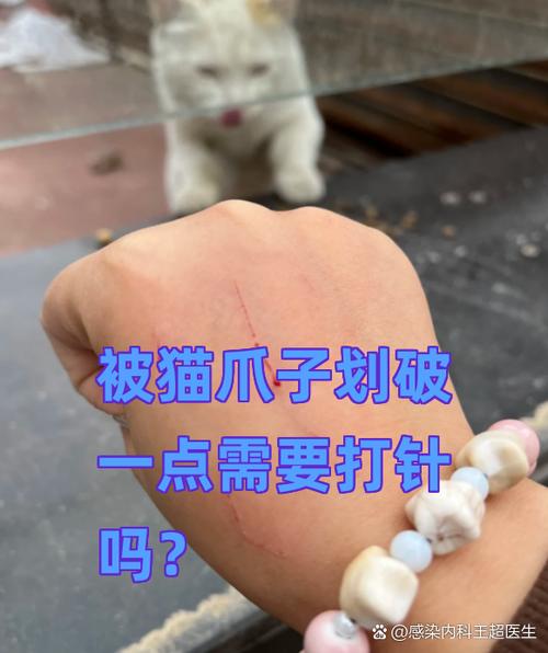 被猫爪子划破一点需要打针吗
