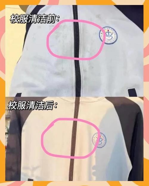 白色衣服发黄是什么原因