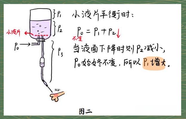 打吊瓶是什么原理