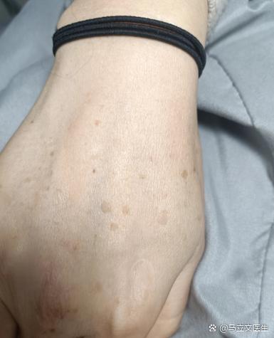 老化的特征有哪些