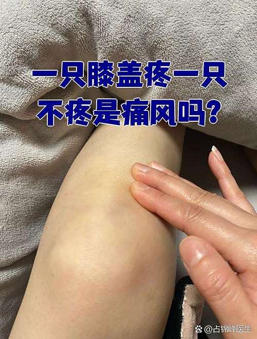 一只膝盖疼一只不疼