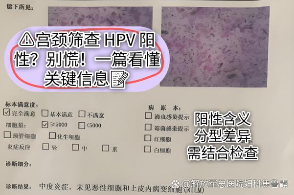 妇女宫颈hpv阳性怎么得的