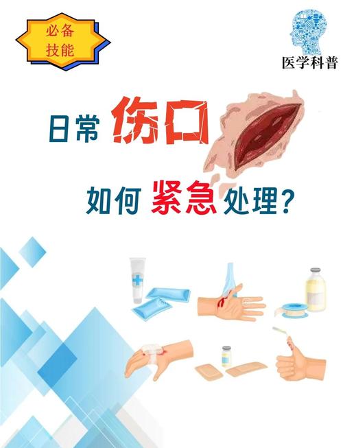 zippers夹伤如何处理