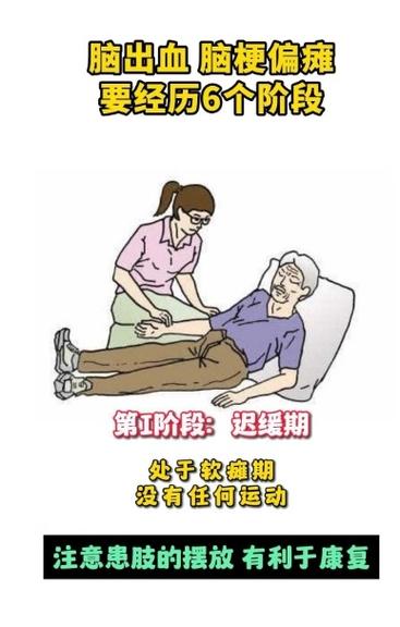 脑梗怎样才恢复得快