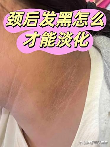 长期吃褪黑色素的危害