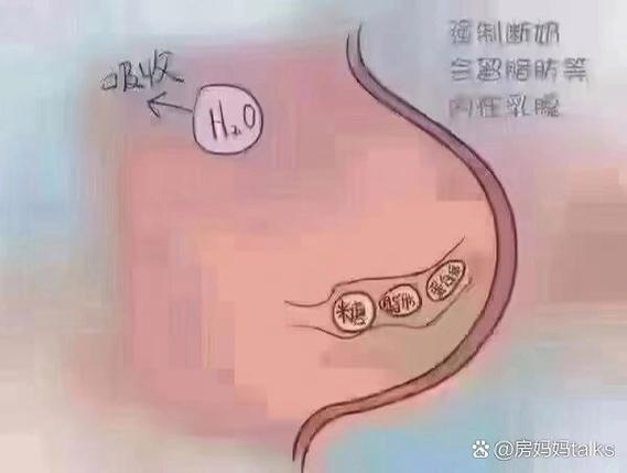 长期用吸奶器的危害