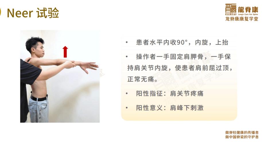neer征阳性