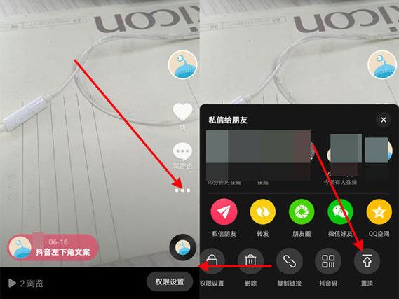 抖音里置顶在哪里设置
