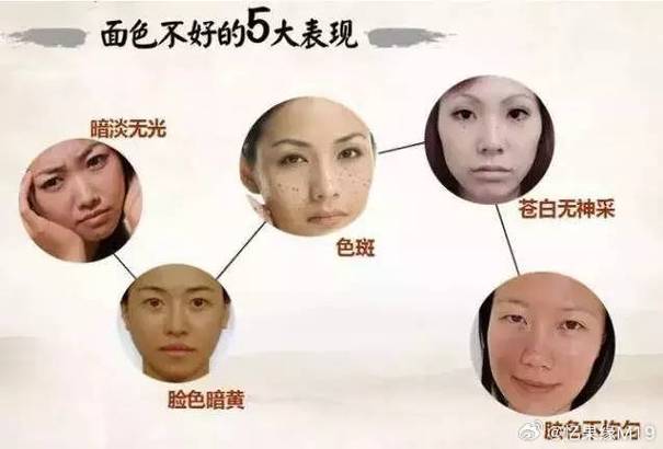 肾虚会脸色发黄吗