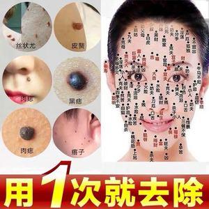 除痣掉渣后怎么修复快