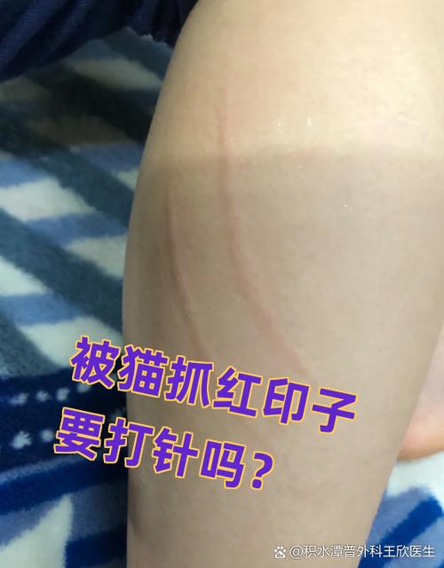 被猫抓了轻轻的划痕
