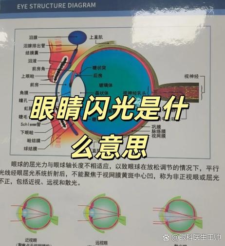 眼睛闪光是什么原因造成的