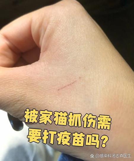 被猫挠破用不用打狂犬疫苗