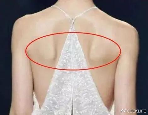 蝴蝶骨位置图片 蝴蝶骨位置图片