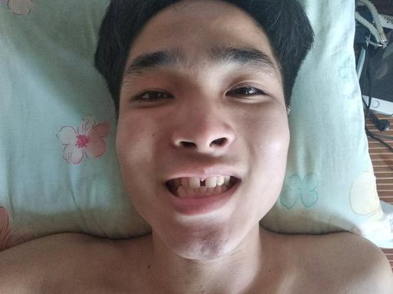 为什么后置拍的脸歪