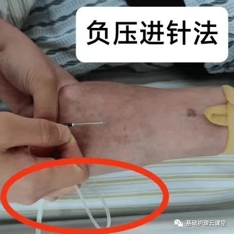 老滚五改变人物血量